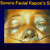 thumbnail image of Kaposi sarcoma: facial, severe