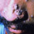 thumbnail image of Varicella-zoster: acyclovir resistant