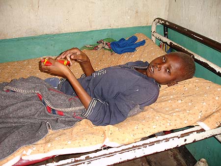 image of Malnutrition: severe, in a 19-year-old boy