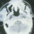 thumbnail image of Non-Hodgkin lymphoma: CT scan showing parotid mass