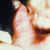 thumbnail image of Ulcer: idiopathic