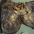 thumbnail image of Kaposi sarcoma: diaphragm at autopsy