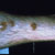 thumbnail image of Flea bites