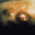 thumbnail image of Bacillary angiomatosis