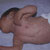 thumbnail image of Scabies: in an infant with HIV
