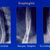 thumbnail image of Esophagitis