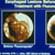 thumbnail image of Candidal esophagitis: lesions before and after treatment with fluconazole