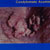 thumbnail image of Condyloma acuminatum: anogenital warts (perianal)