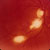 thumbnail image of  Toxoplasma gondii
                    : retinal lesions (full thickness)
                