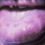 thumbnail image of Herpes simplex: oral ulcers
