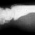 thumbnail image of  Bartonella henselae
                    /Bacillary angiomatosis: wrist X ray
                