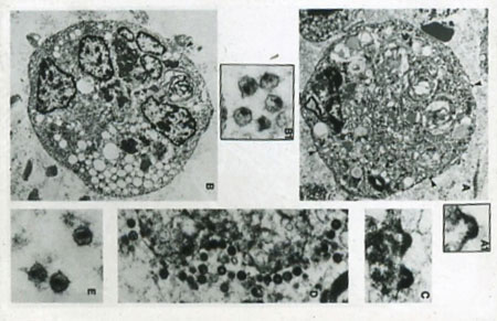 image of Human immunodeficiency virus