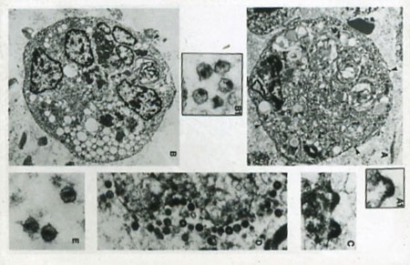 electron microscopy hiv